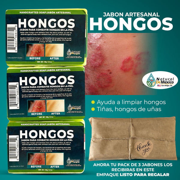 Curative Soap for Mushrooms Pack of 3 free facial sponge cleanses fungus,bacteri