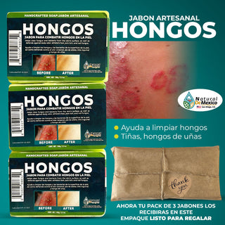 Jabon Curativo para Hongos Pack de 3 esponja facial gratis limpia hongos,bacteri